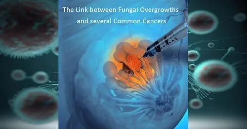 Fungal and Parasitic Imbalance: A Hidden Partnership.