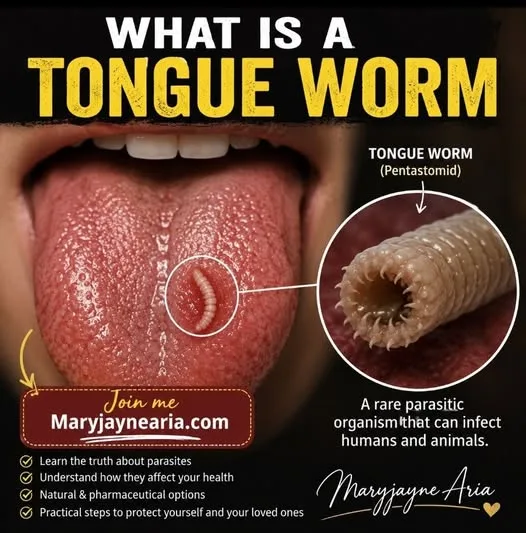 Tongue Worms: