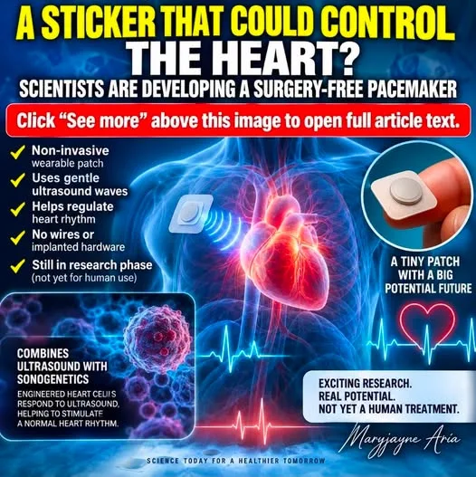 A STICKER THAT COULD CONTROL THE HEART? SCIENTISTS ARE DEVELOPING A SURGERY-FREE PACEMAKER